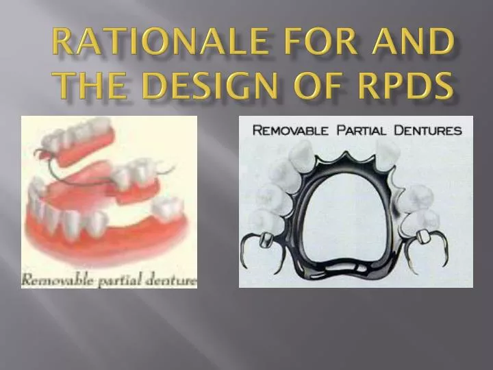 rationale for and the design of rpds