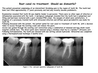 Root canal re-treatment. Should we dismantle?