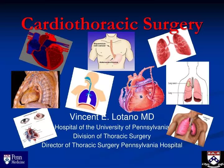 cardiothoracic surgery