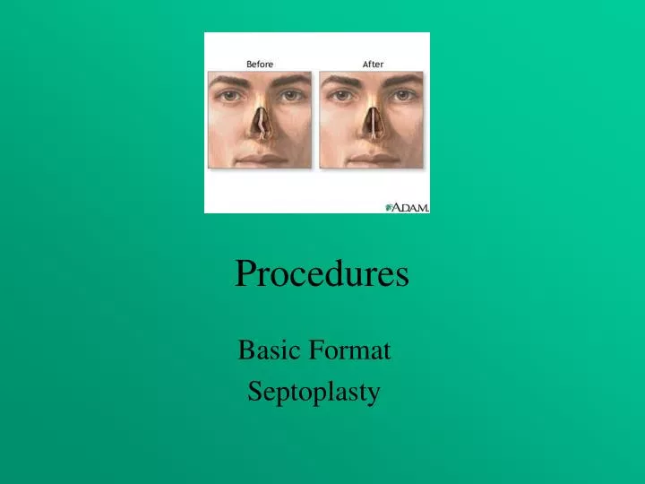 procedures