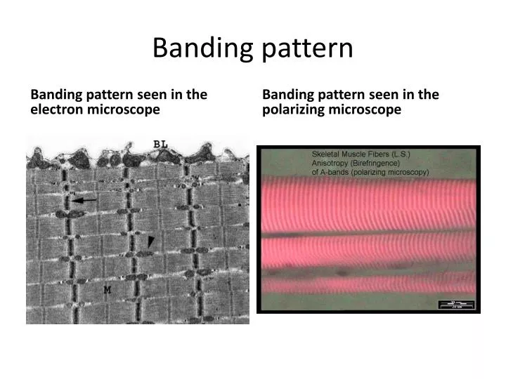 banding pattern