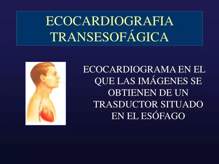 ecocardiografia transesof gica
