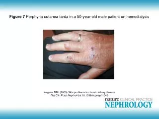 Kuypers DRJ (2009) Skin problems in chronic kidney disease