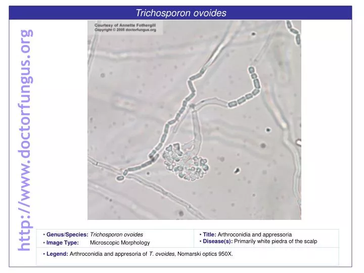 trichosporon ovoides