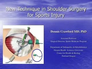 New Technique in Shoulder Surgery for Sports Injury