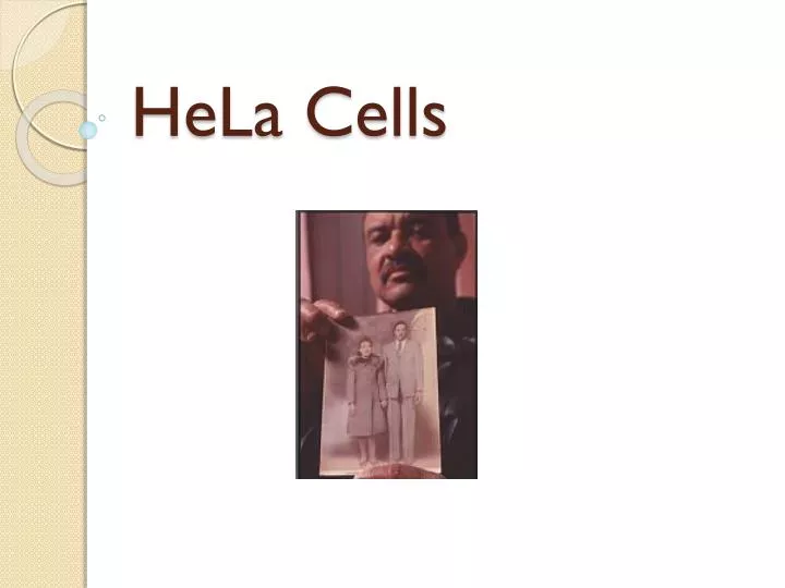 hela cells