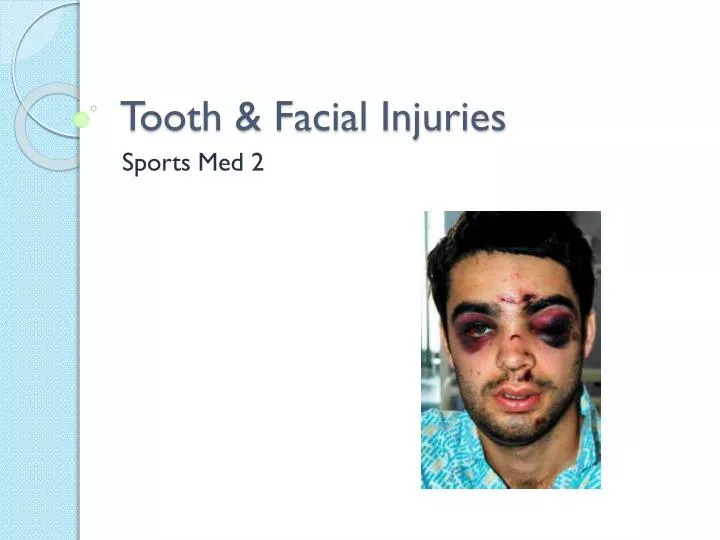 tooth facial injuries