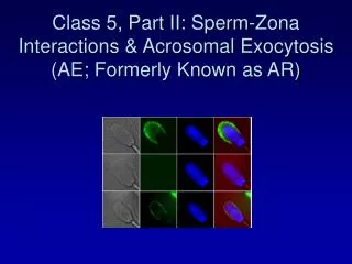 Class 5, Part II: Sperm-Zona Interactions &amp; Acrosomal Exocytosis (AE; Formerly Known as AR)