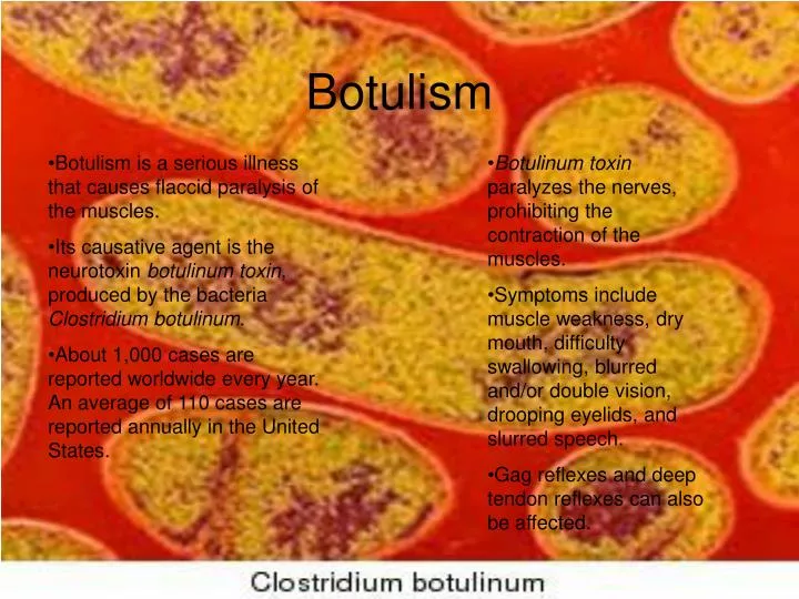 botulism