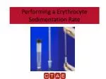 Performing a Erythrocyte Sedimentation Rate - slide 1