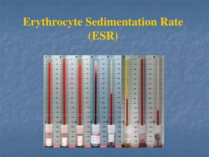 erythrocyte sedimentation rate esr