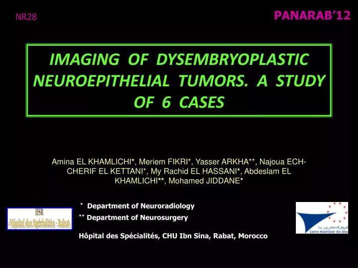 imaging of dysembryoplastic neuroepithelial tumors a study of 6 cases