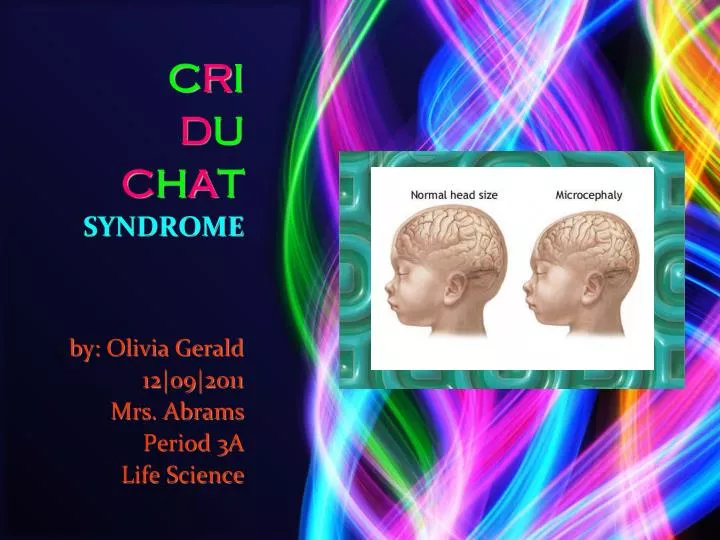 c r i d u c h a t syndrome by olivia gerald 12 o9 2011 mrs abrams period 3a life science