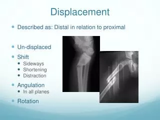 displacement