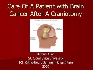 Care Of A Patient with Brain Cancer After A Craniotomy
