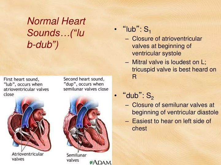 normal heart sounds lub dub