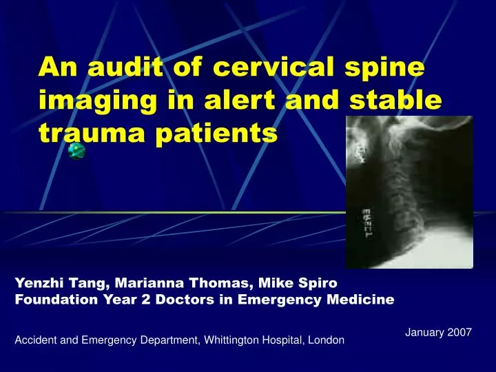 an audit of cervical spine imaging in alert and stable trauma patients