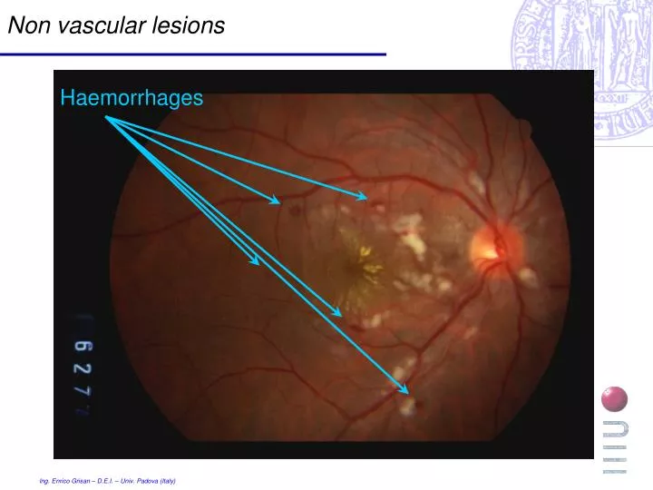 non vascular lesions