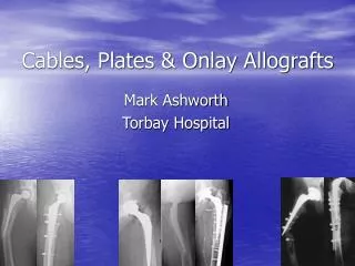 Cables, Plates &amp; Onlay Allografts