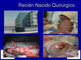 reci n nacido quir rgico