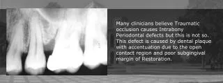 Tissue Changes Due to Traumatic Occlusion