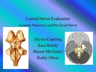 Cranial Nerve Evaluation Acoustic Neuroma and the Facial Nerve