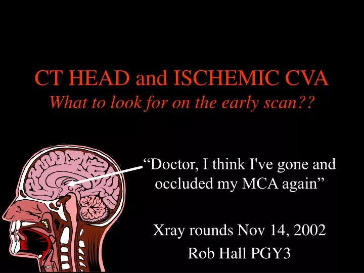 ct head and ischemic cva what to look for on the early scan