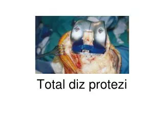 total diz protezi