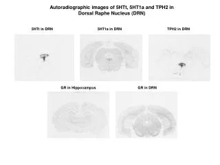 Autoradiographic images of 5HTt, 5HT1a and TPH2 in Dorsal Raphe Nucleus (DRN)