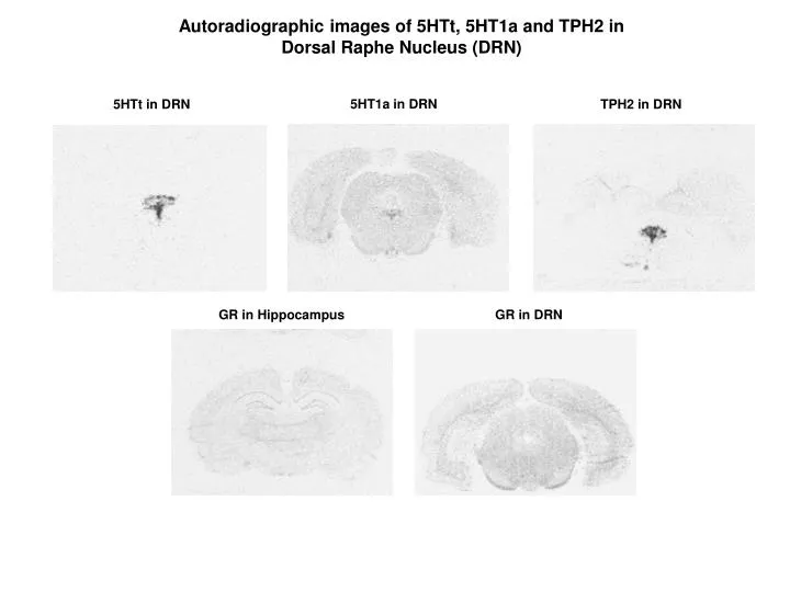 autoradiographic images of 5htt 5ht1a and tph2 in dorsal raphe nucleus drn