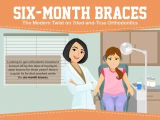 Six-Month Braces - The Modern Twist on Orthodontics