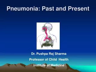 Pneumonia: Past and Present