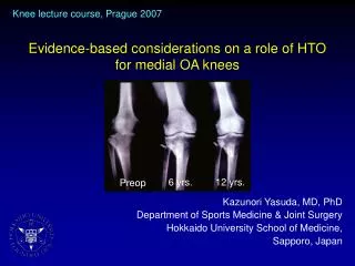 Evidence-based considerations on a role of HTO for medial OA knees