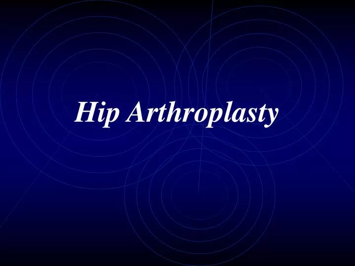 hip arthroplasty