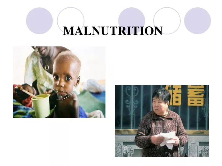 malnutrition