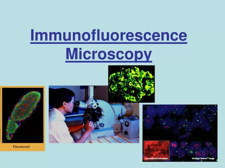immunofluorescence microscopy