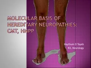 Molecular Basis of Hereditary Neuropathies: CMT, HNPP