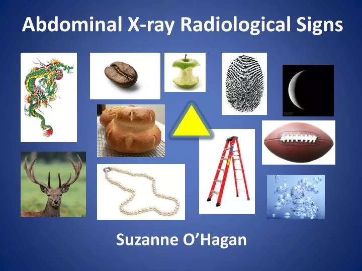 abdominal x ray radiological signs
