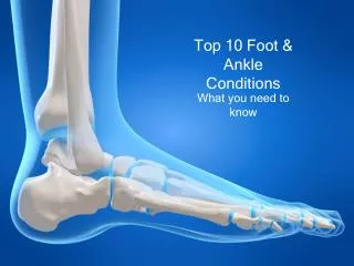 Top 10 Foot &amp; Ankle Conditions