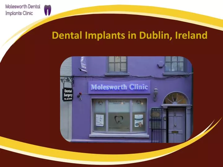 dental implants in dublin ireland