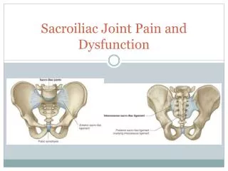 Sacroiliac Joint Pain and Dysfunction