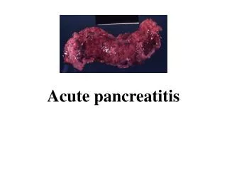 Acute pancreatitis