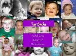 Tay Sachs - slide 1