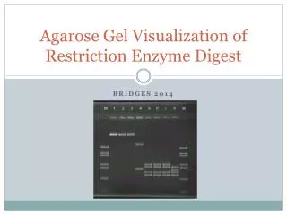 Agarose Gel Visualization of Restriction Enzyme Digest
