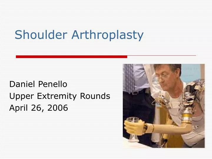 shoulder arthroplasty