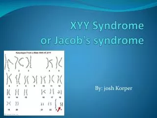 XYY Syndrome or Jacob's syndrome