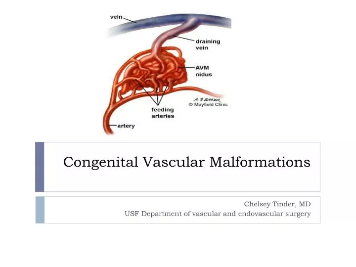congenital vascular malformations