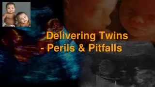 Delivering Twins - Perils &amp; Pitfalls