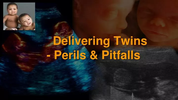 delivering twins perils pitfalls