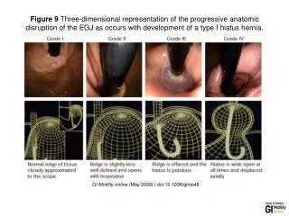 GI Motility online (May 2006) | doi:10.1038/gimo48